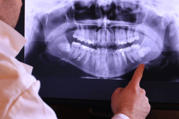 Best Emergency Dentist for Special Needs Patients in Potterville, MI
