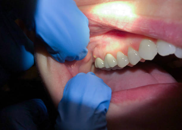 Best Pediatric Emergency Dentist in Potterville, MI