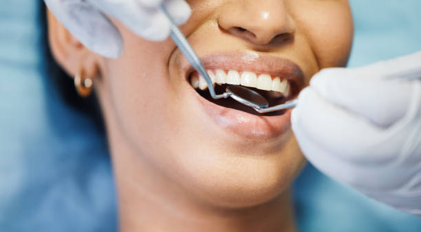 Best Broken or Cracked Tooth Emergency Dentist in Potterville, MI