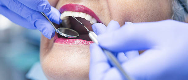 Best Emergency Dental Care for Abscessed Tooth in Potterville, MI