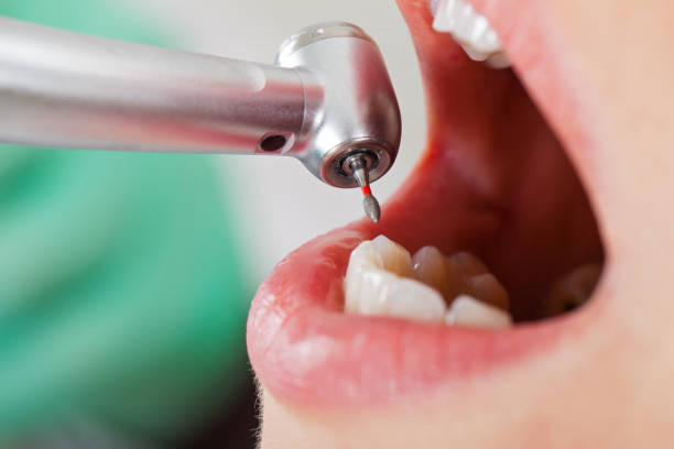 Best Orthodontic Emergency Dentist in Potterville, MI